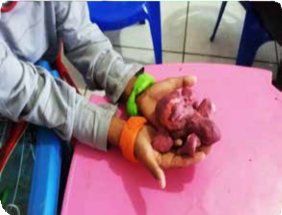 Imagem 2. Criança cria caranguejos e pulseiras com massas co-loridas de modelar. (Ciudad de Chapecó, 2018) Fonte: Acervo do autor.